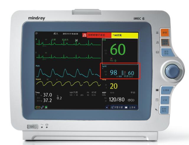 icu仪表(icu仪表控制)